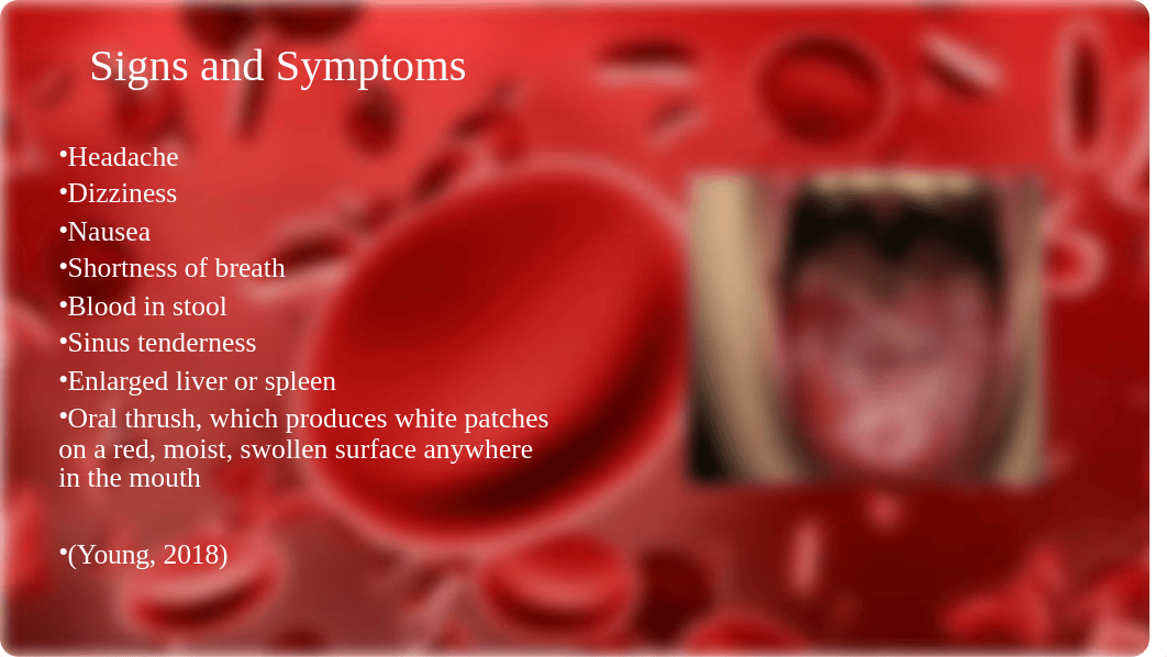 Anemia Powerpoint.pptx_drh0us2i29e_page2