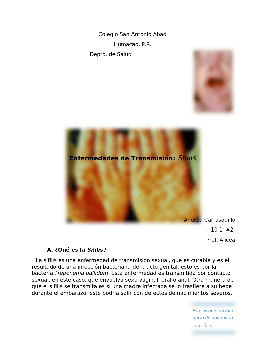 enfermedad_de_transmision_sifilis_drjv6t8snbt_page1