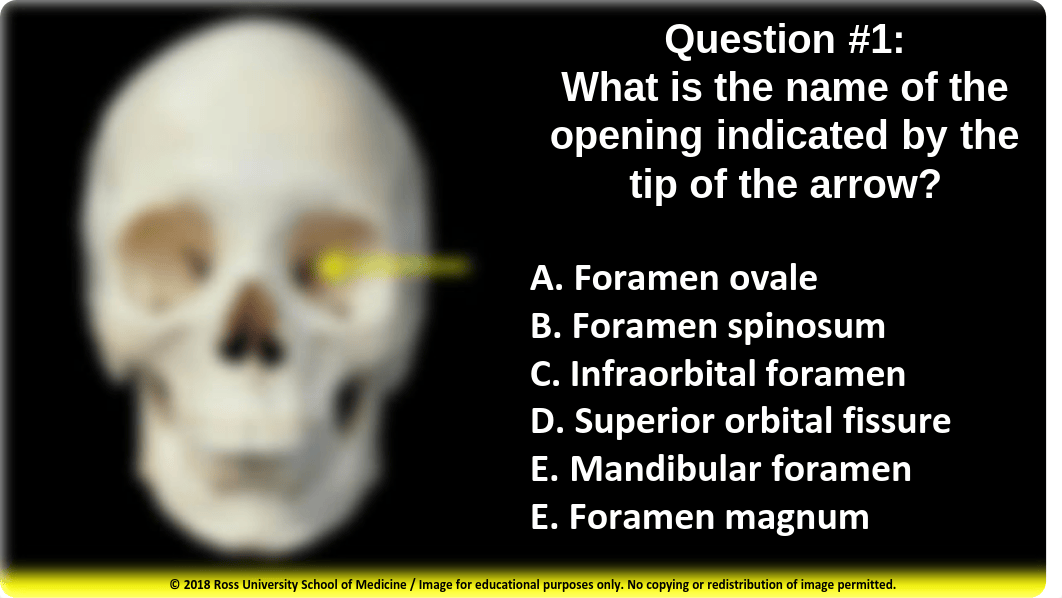 Skull and Cranial Fossa (in class assessment).pdf_drjwgzj0ooo_page2