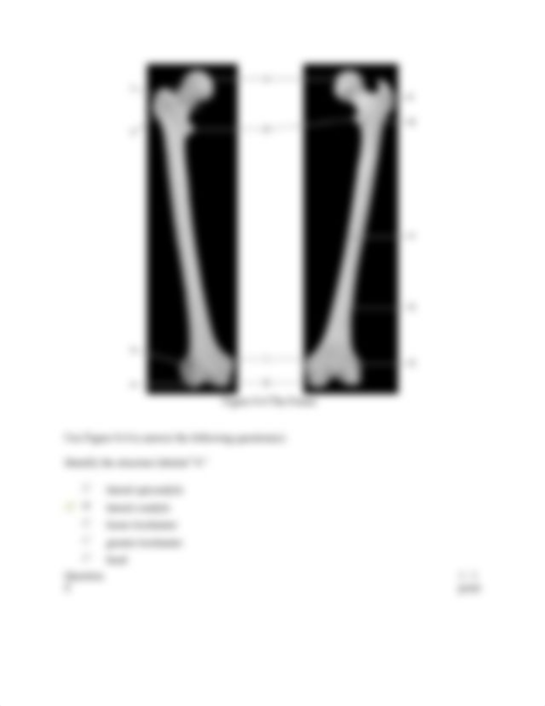 Appendicular Skeleton 8-4_drmatek2hac_page5