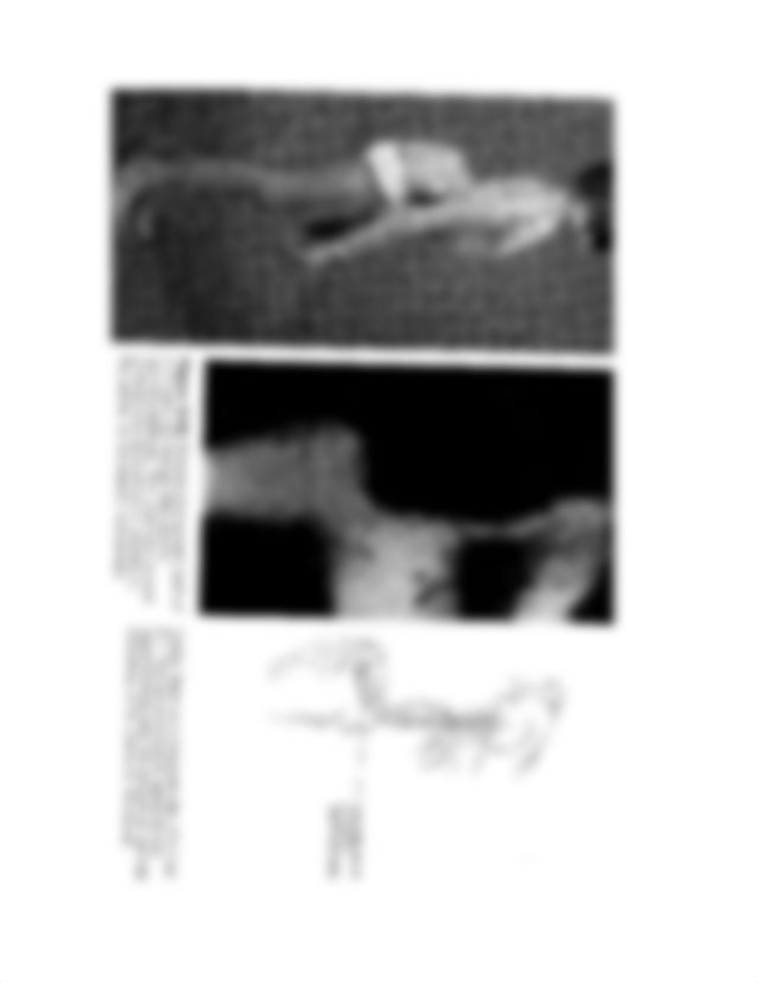 RADD 2612 Spondyloptosis_drtul4rng9x_page1