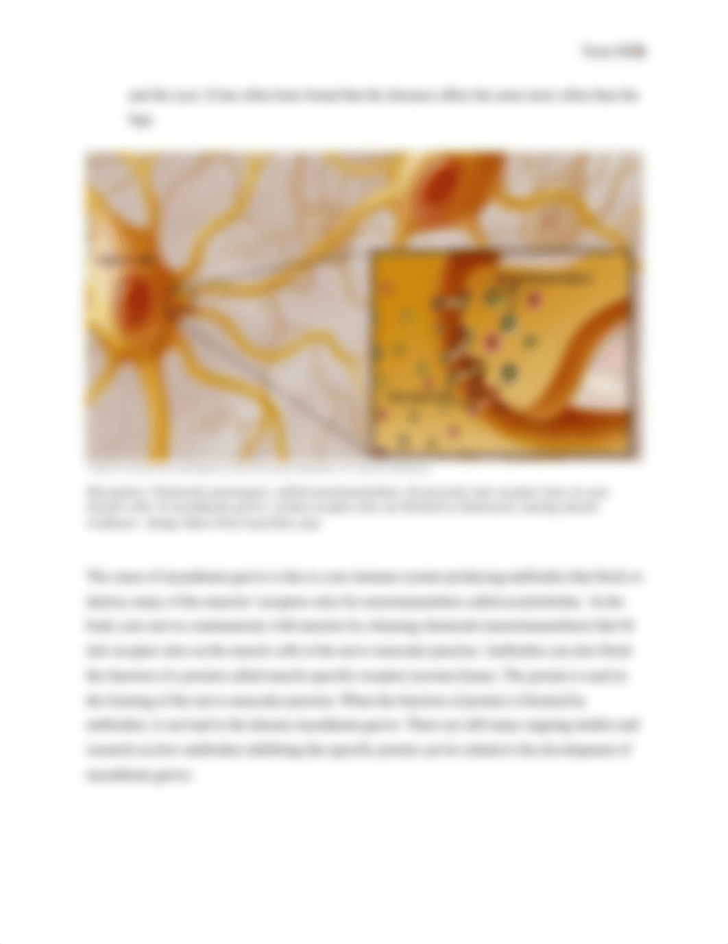 Myasthenia Gravis- Tessa Mills.docx_drwjj3w6q1k_page2