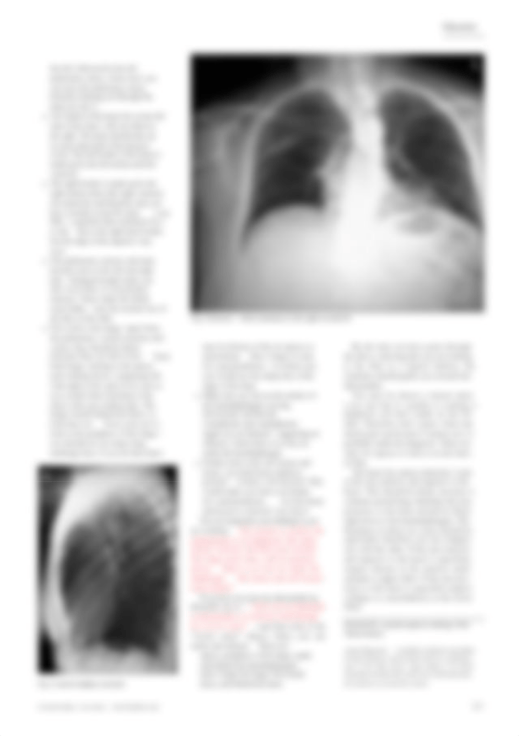 Chest x-ray made easy BMJ[All 5 articles].pdf_drznisn3sic_page2