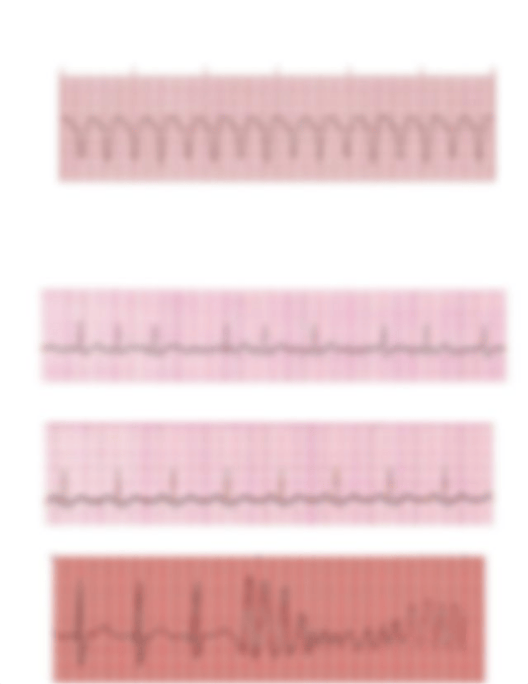 Rhythm Interpretation- EKG Final.docx_ds3l04u40sy_page3