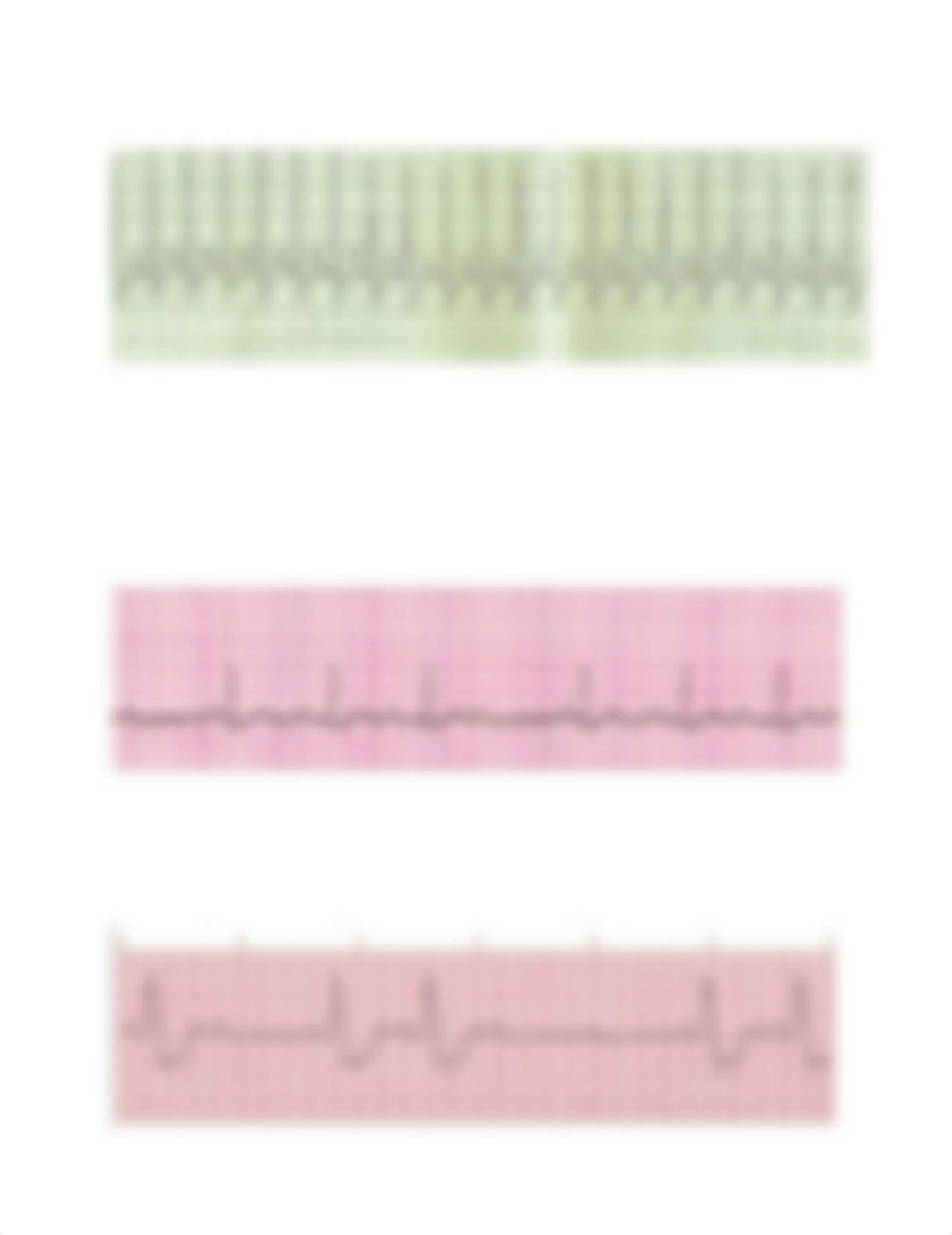 Rhythm Interpretation- EKG Final.docx_ds3l04u40sy_page5