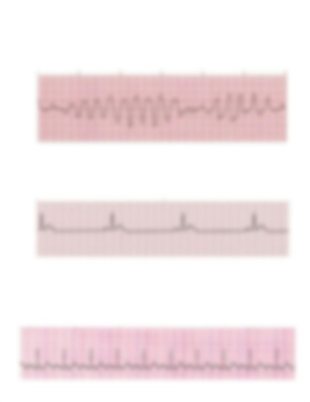 Rhythm Interpretation- EKG Final.docx_ds3l04u40sy_page2