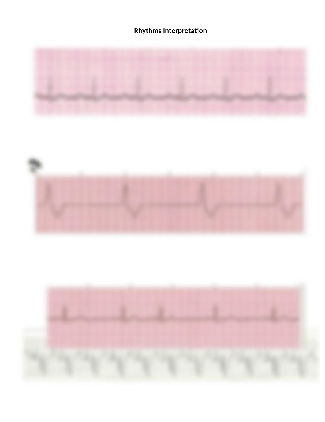 Rhythm Interpretation- EKG Final.docx_ds3l04u40sy_page1