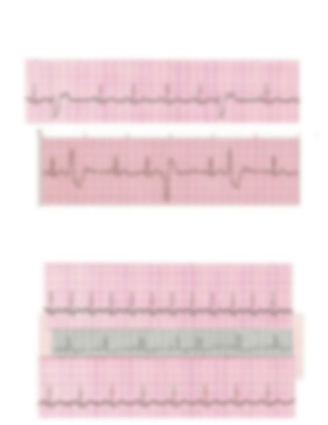 Rhythm Interpretation- EKG Final.docx_ds3l04u40sy_page4