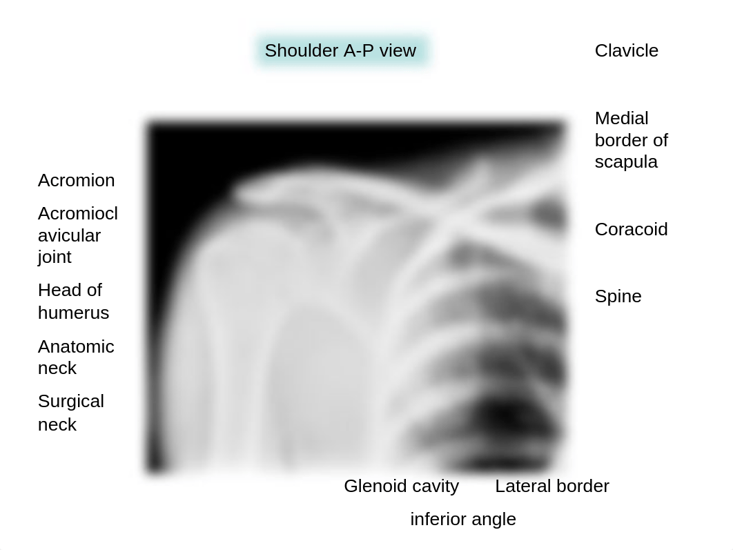 14 Radiographs of upper limb_ds5nonwx266_page4