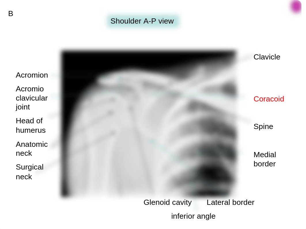 14 Radiographs of upper limb_ds5nonwx266_page5