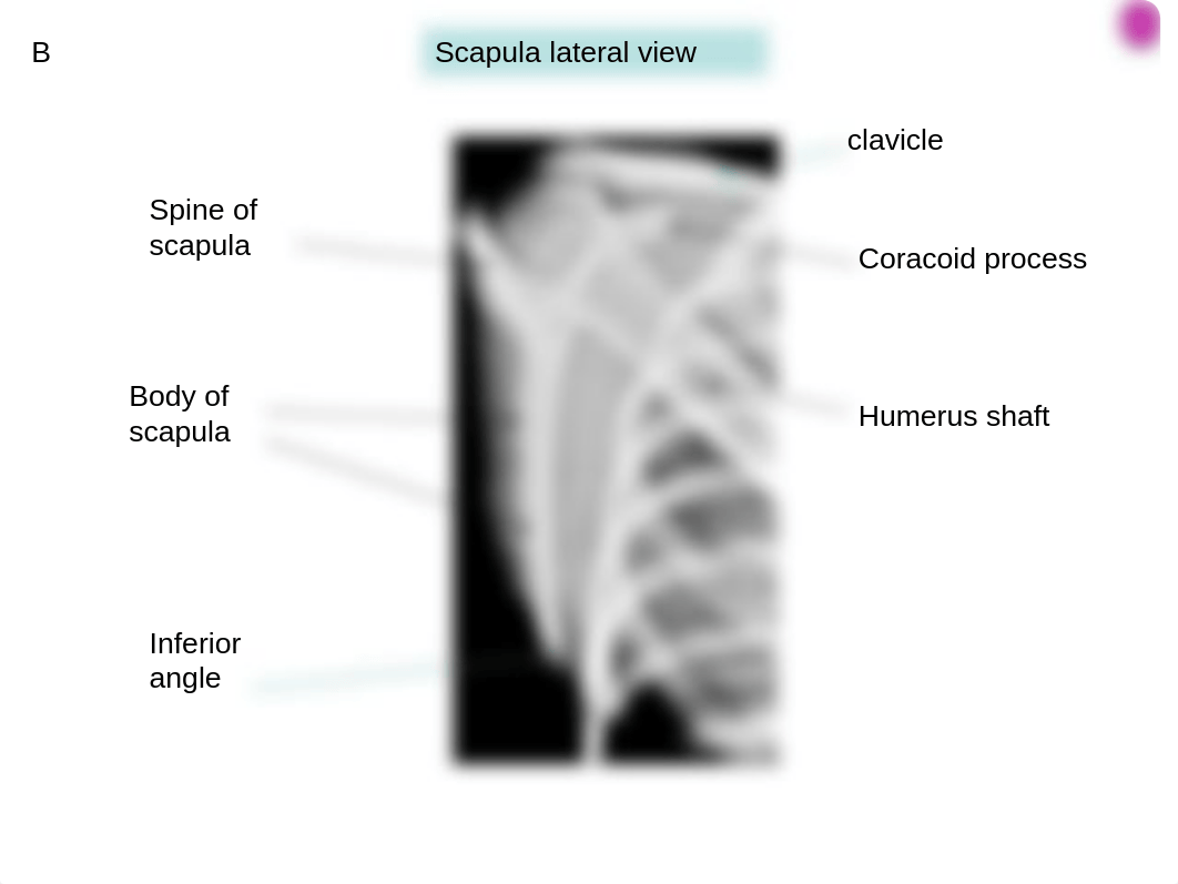 14 Radiographs of upper limb_ds5nonwx266_page3