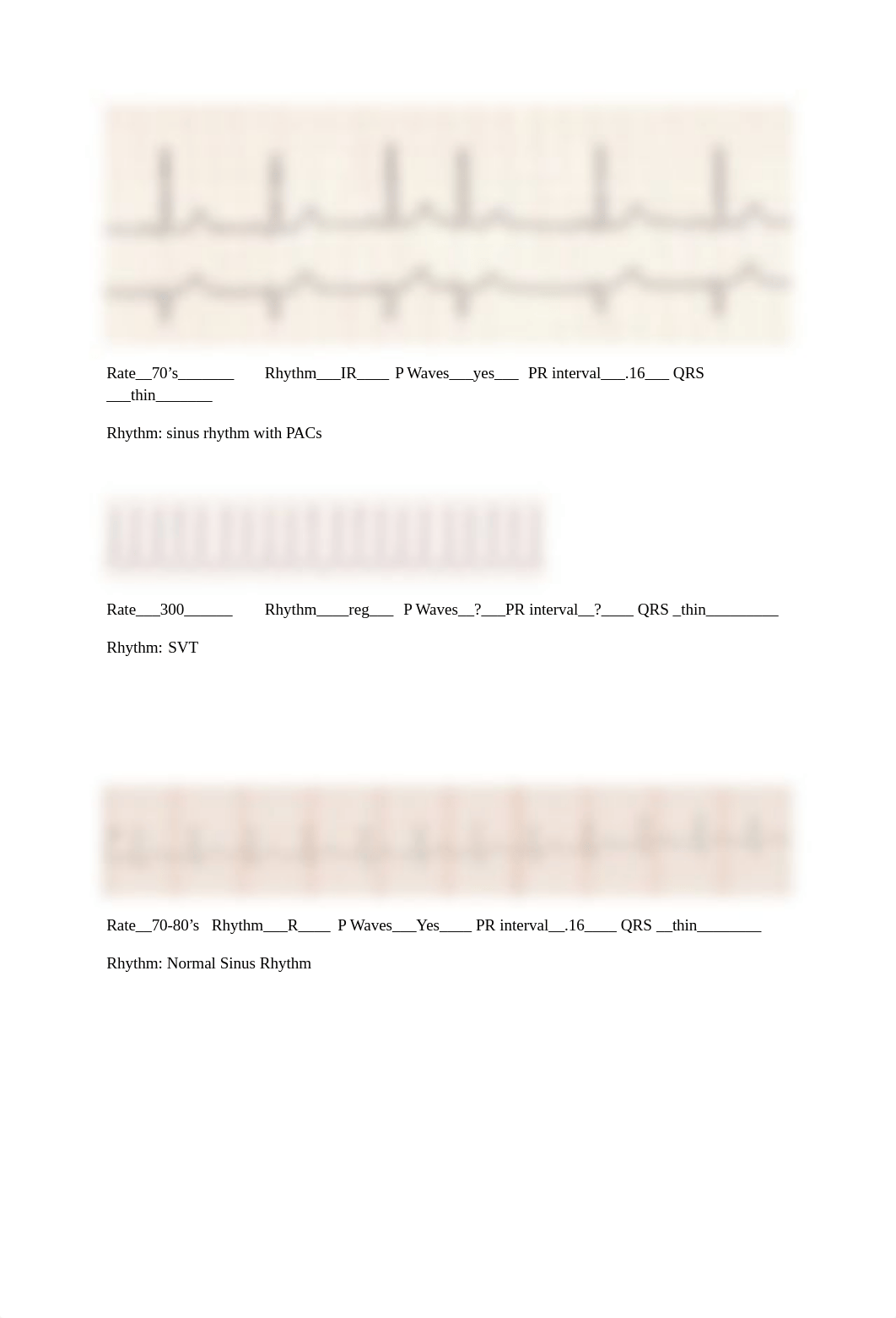 206 Cardiac Monitoring Worksheet key.docx_ds5t4h8o0ms_page2