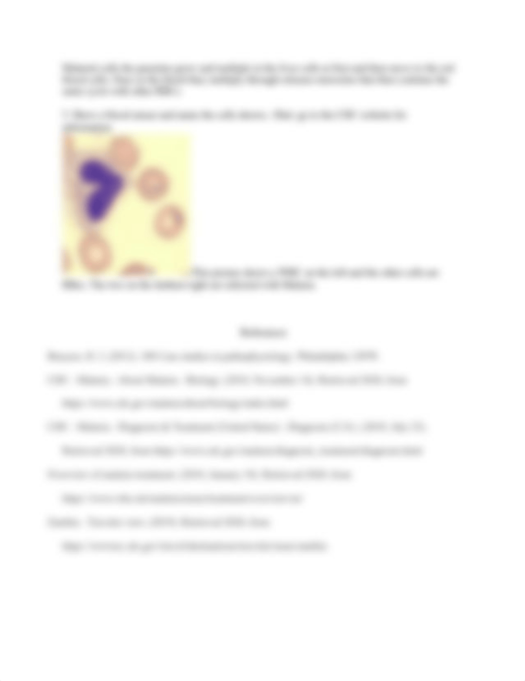 Immune Case study zoe hays.docx_ds5za3dhxth_page2