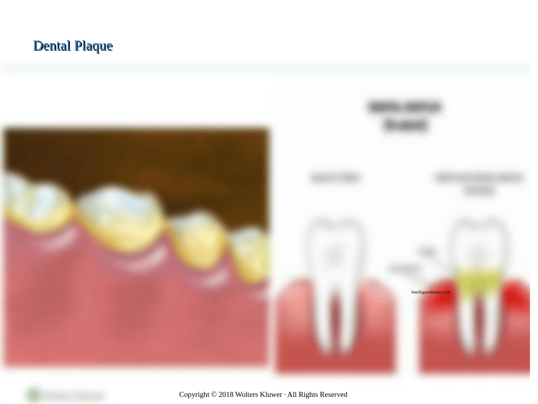 NURS346Chapter45 - oral disorders .pptx_ds71r0w9byu_page5