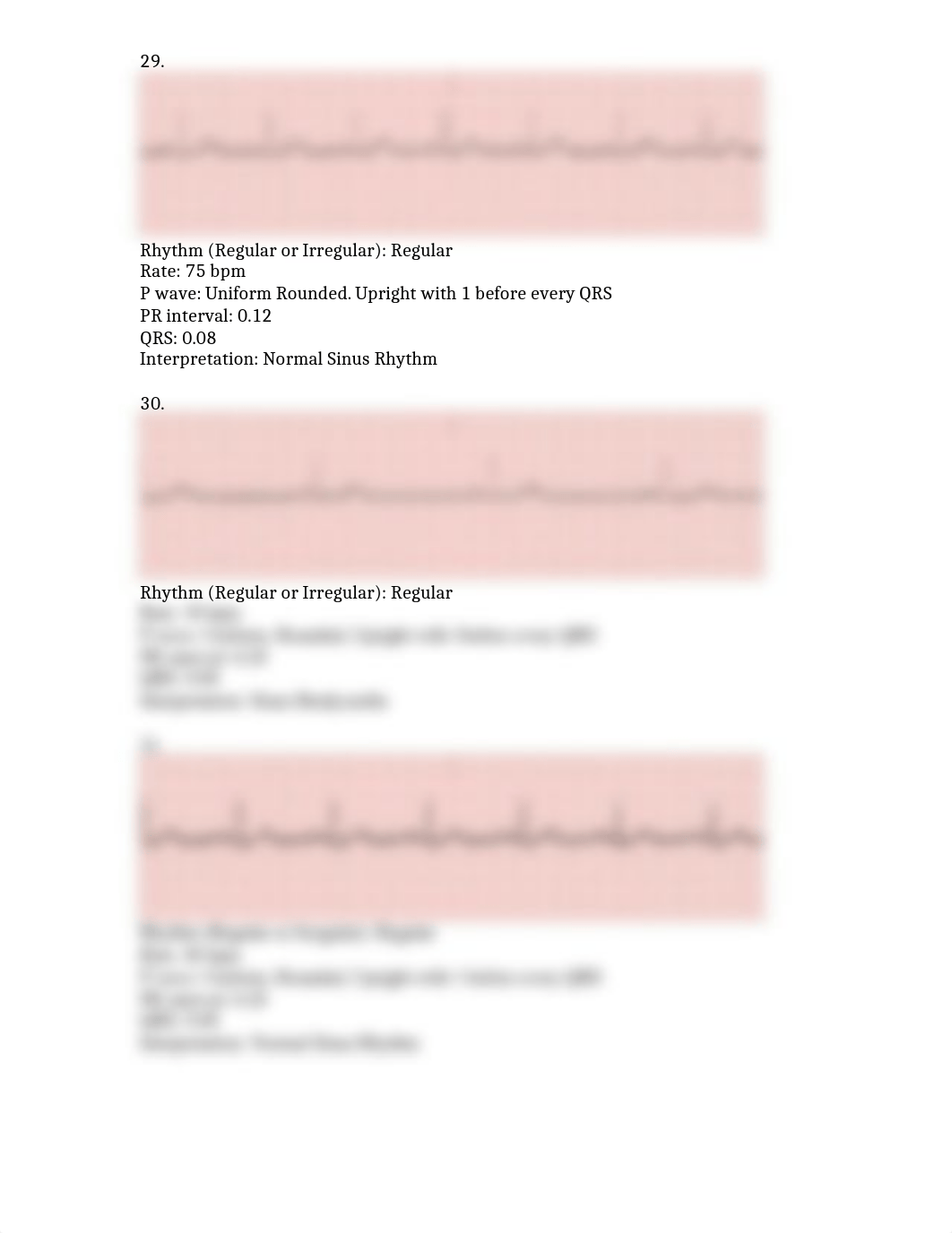 Unit 3  Sinus Rhythm Assignment_ds8p4fsg9jm_page2