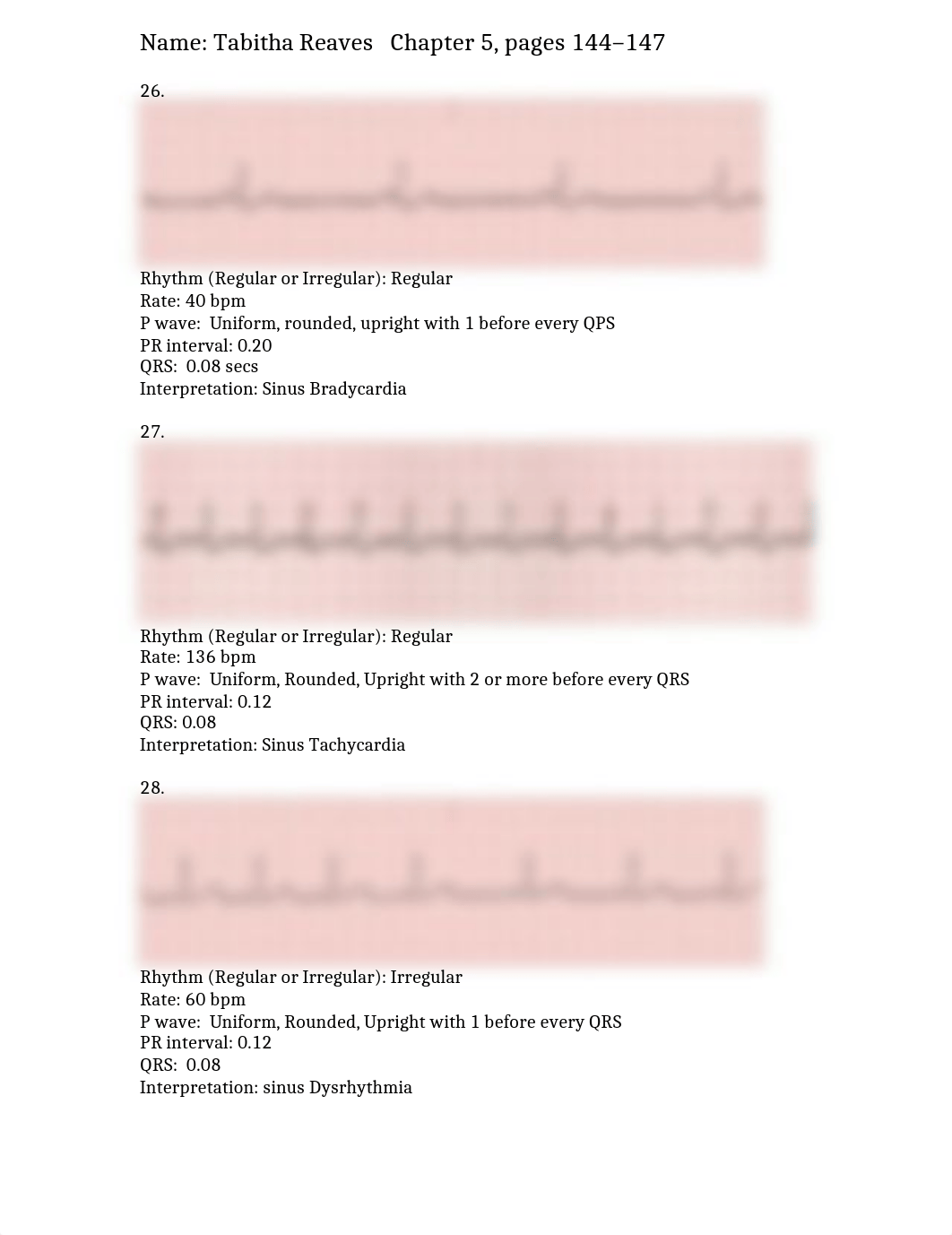 Unit 3  Sinus Rhythm Assignment_ds8p4fsg9jm_page1