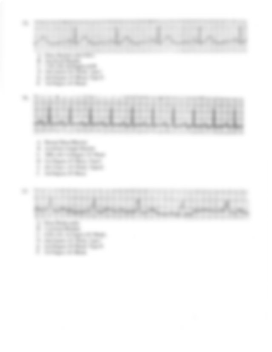 MSN 6010 ECG Rythm Interpretation.pdf_ds9hgeivmf1_page5