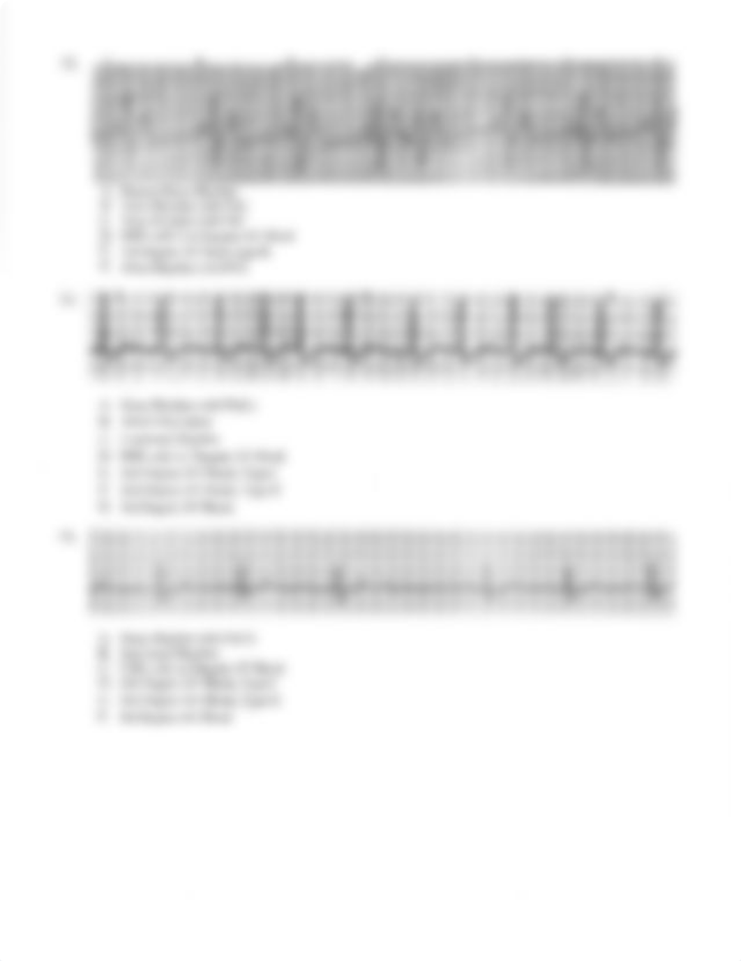 MSN 6010 ECG Rythm Interpretation.pdf_ds9hgeivmf1_page4