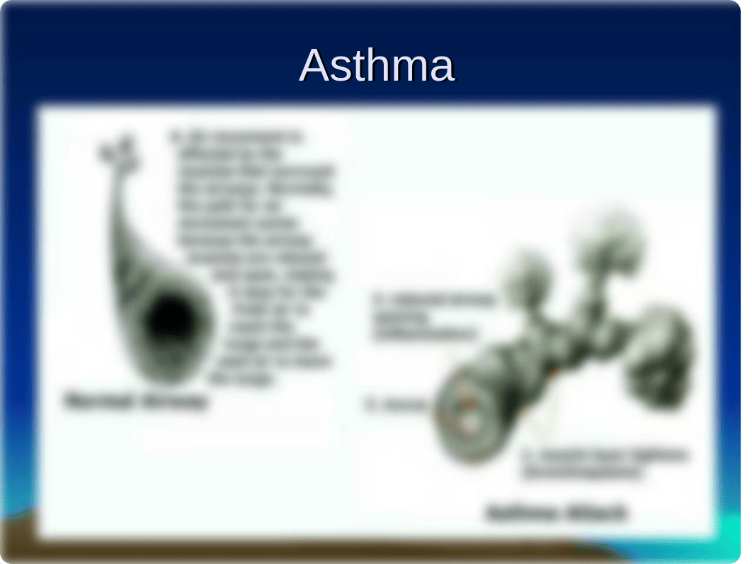 Asthma, Chronic Bronchitis and Emphysema.ppt_ds9ozc26j86_page2