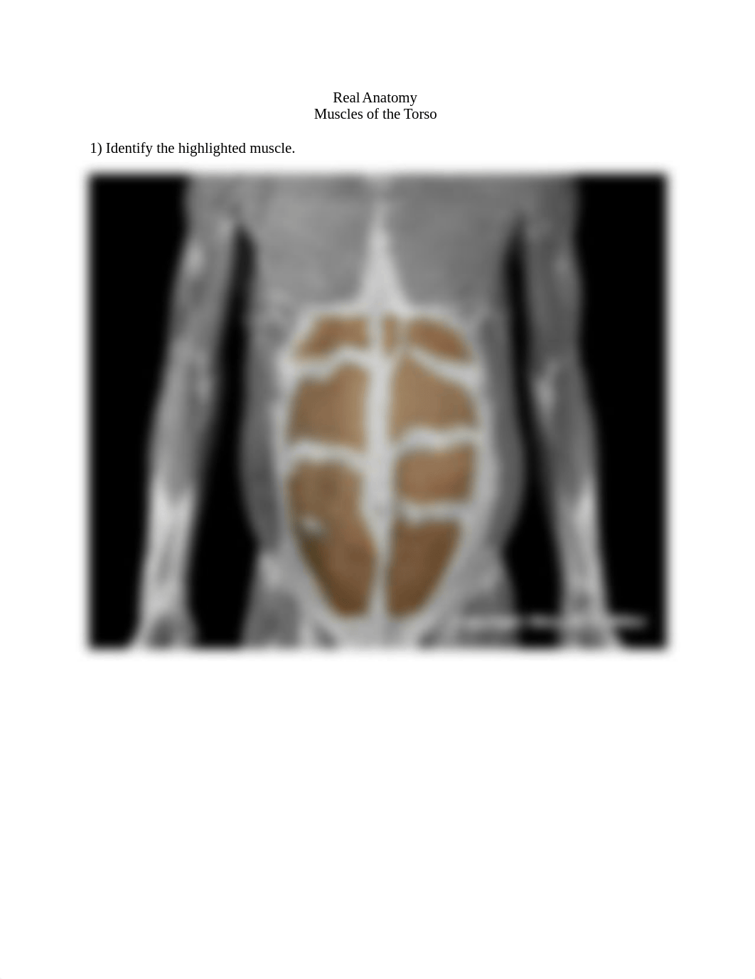 Upper limb and torso muscle anatomy lab (1).docx_ds9qsfldlky_page1