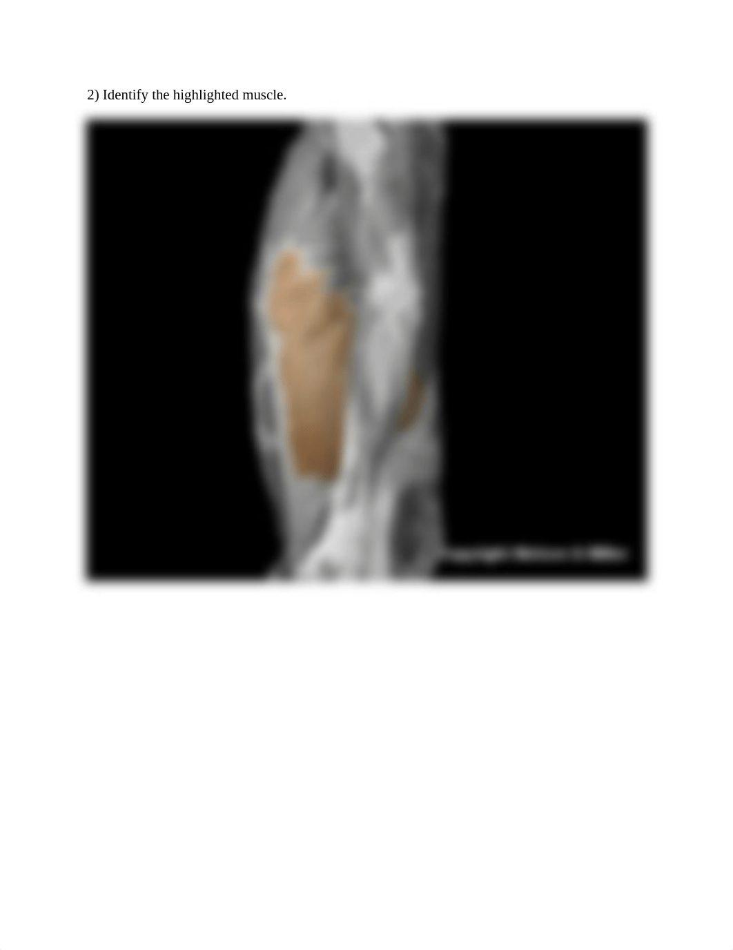 Upper limb and torso muscle anatomy lab (1).docx_ds9qsfldlky_page2