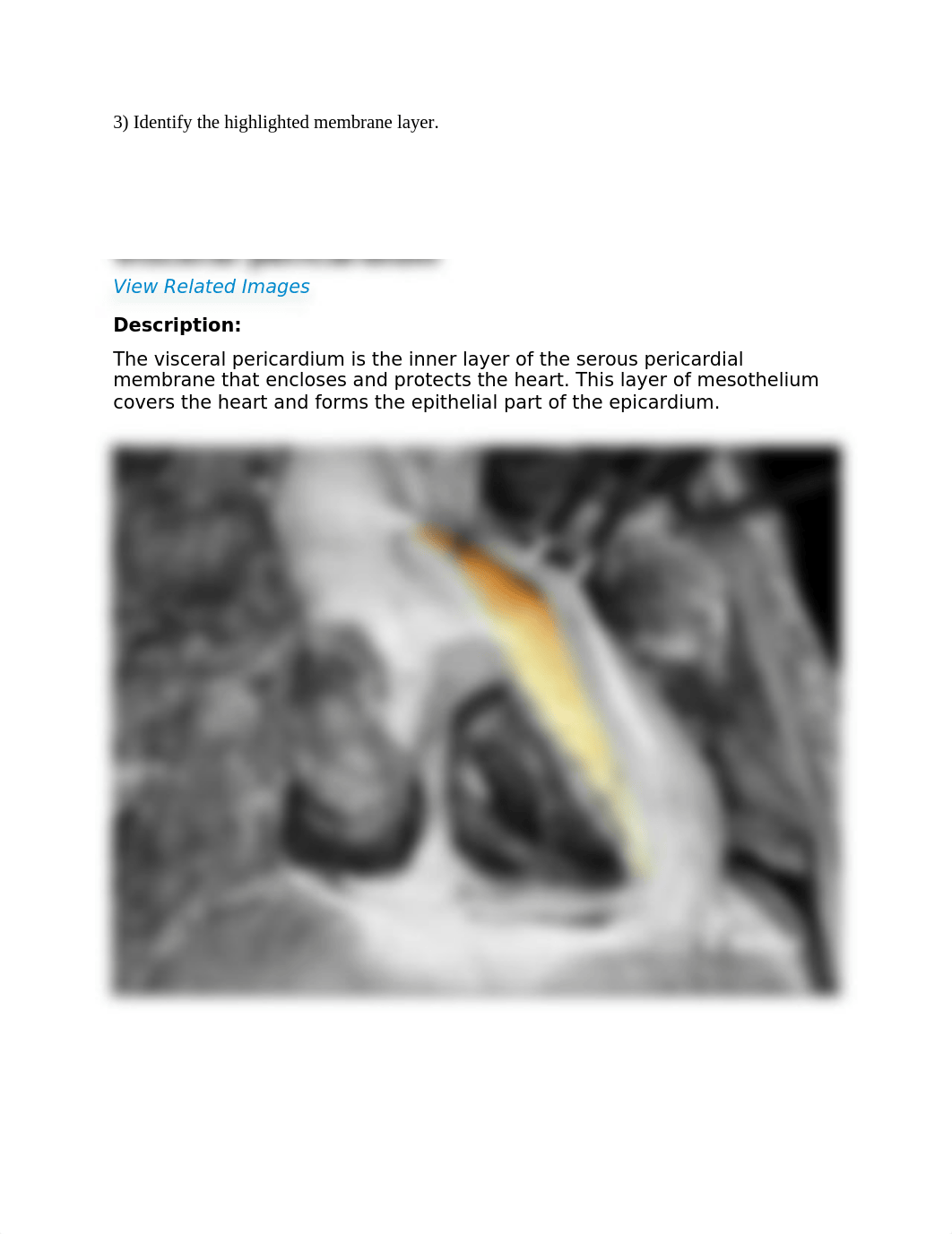 REAL_ANATOMY_LAB_02_heart_pulmonary_and_coronary_circulations.docx_dseu9j65un2_page3