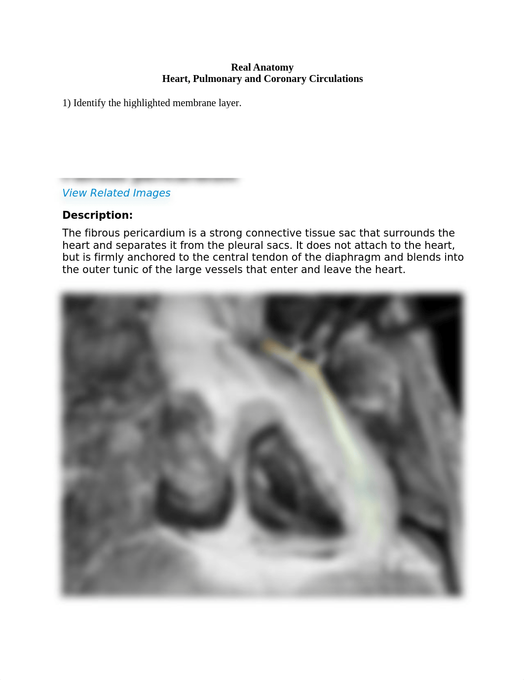 REAL_ANATOMY_LAB_02_heart_pulmonary_and_coronary_circulations.docx_dseu9j65un2_page1