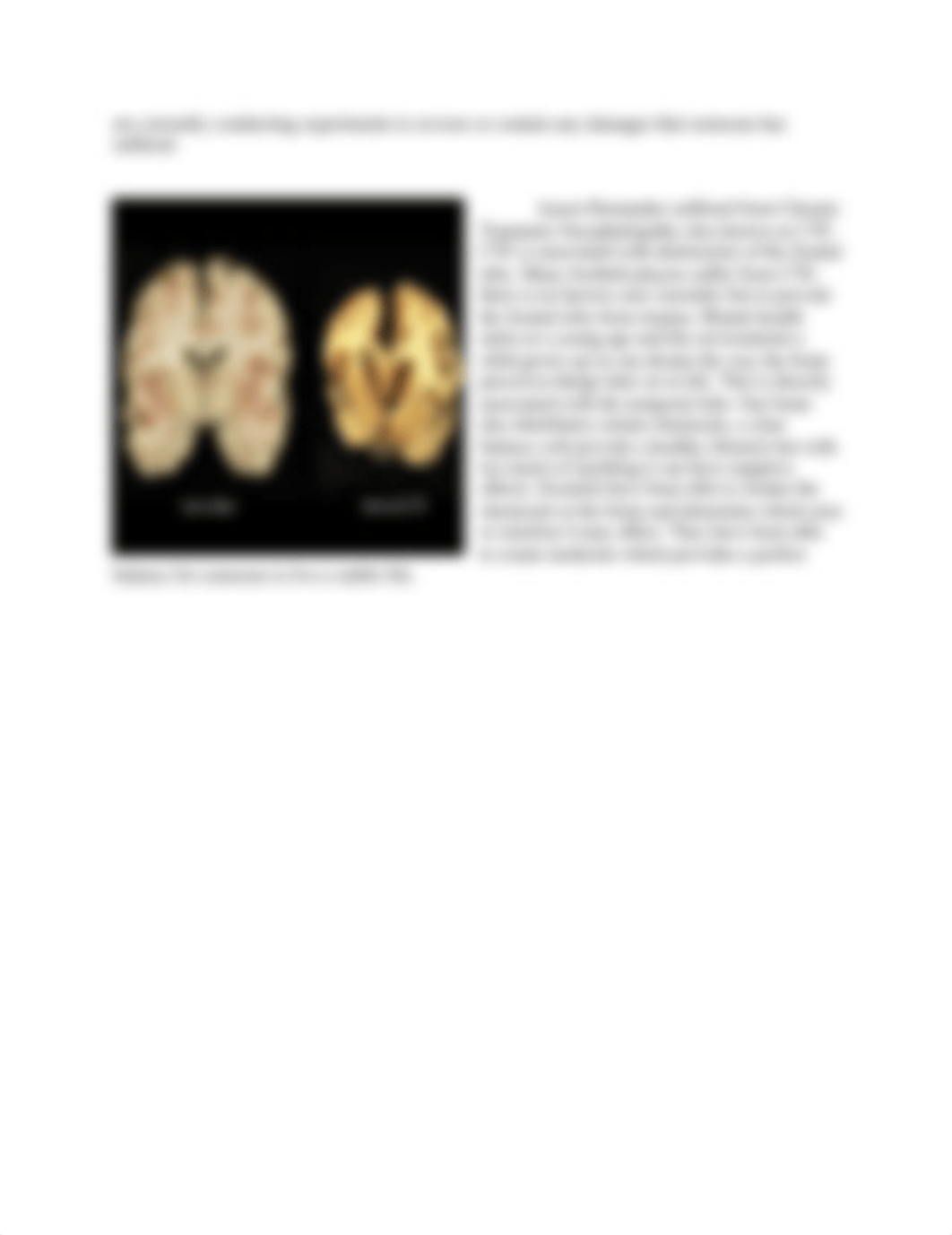 Understanding the Relationship Between the Brain and Mental Health Treatment DB.docx_dsgrabgqqca_page2