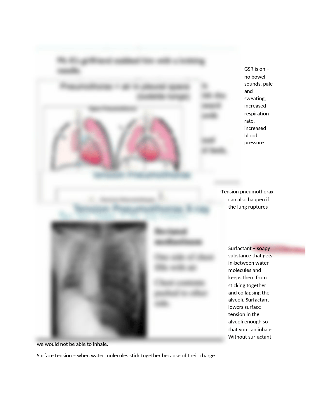 Week 5 Respiratory System and Pleural Disorders.docx_dsifh0fpkh5_page4