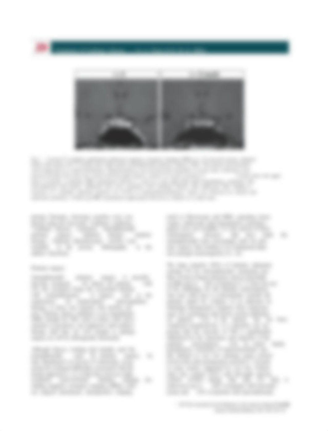 Current Management of Cushings Disease.pdf_dsj1usxmul1_page2