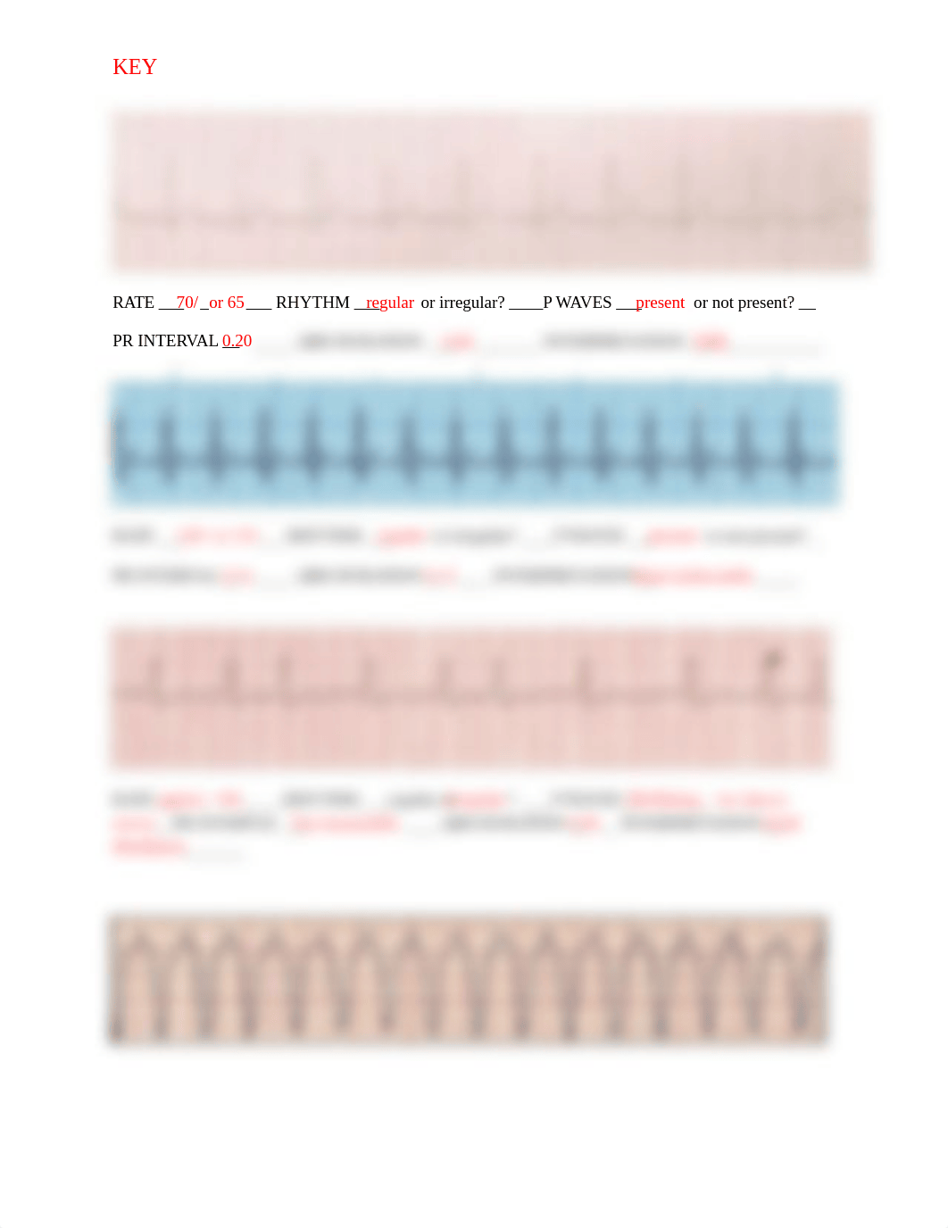 ECG Strip Interpretation Practice KEY (1).docx_dsmmch3ruuz_page2