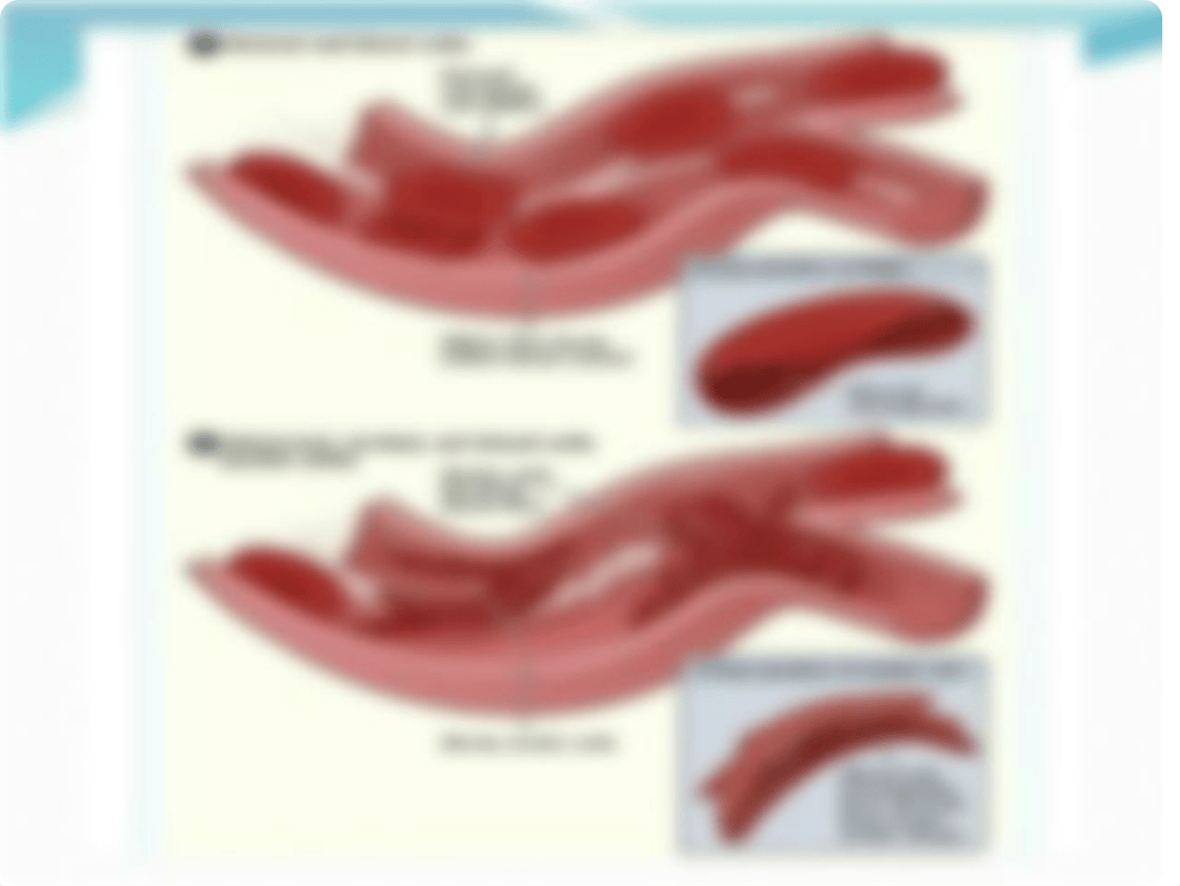 sickle cell anemia.pptx_dsokr8ipuyx_page3