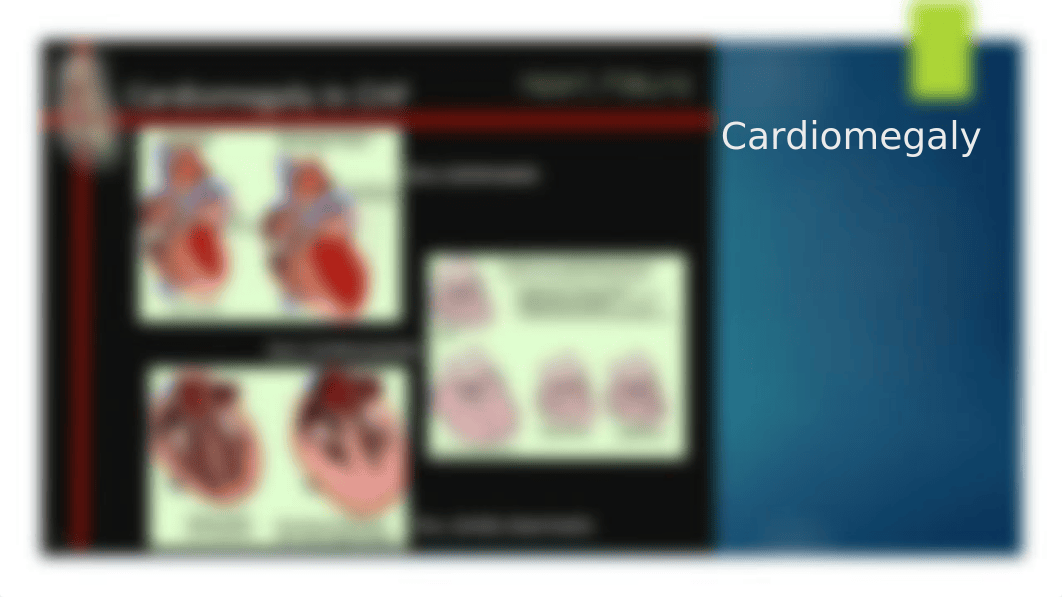 Cardiomegaly.pptx_dsqtsmsrzrl_page3