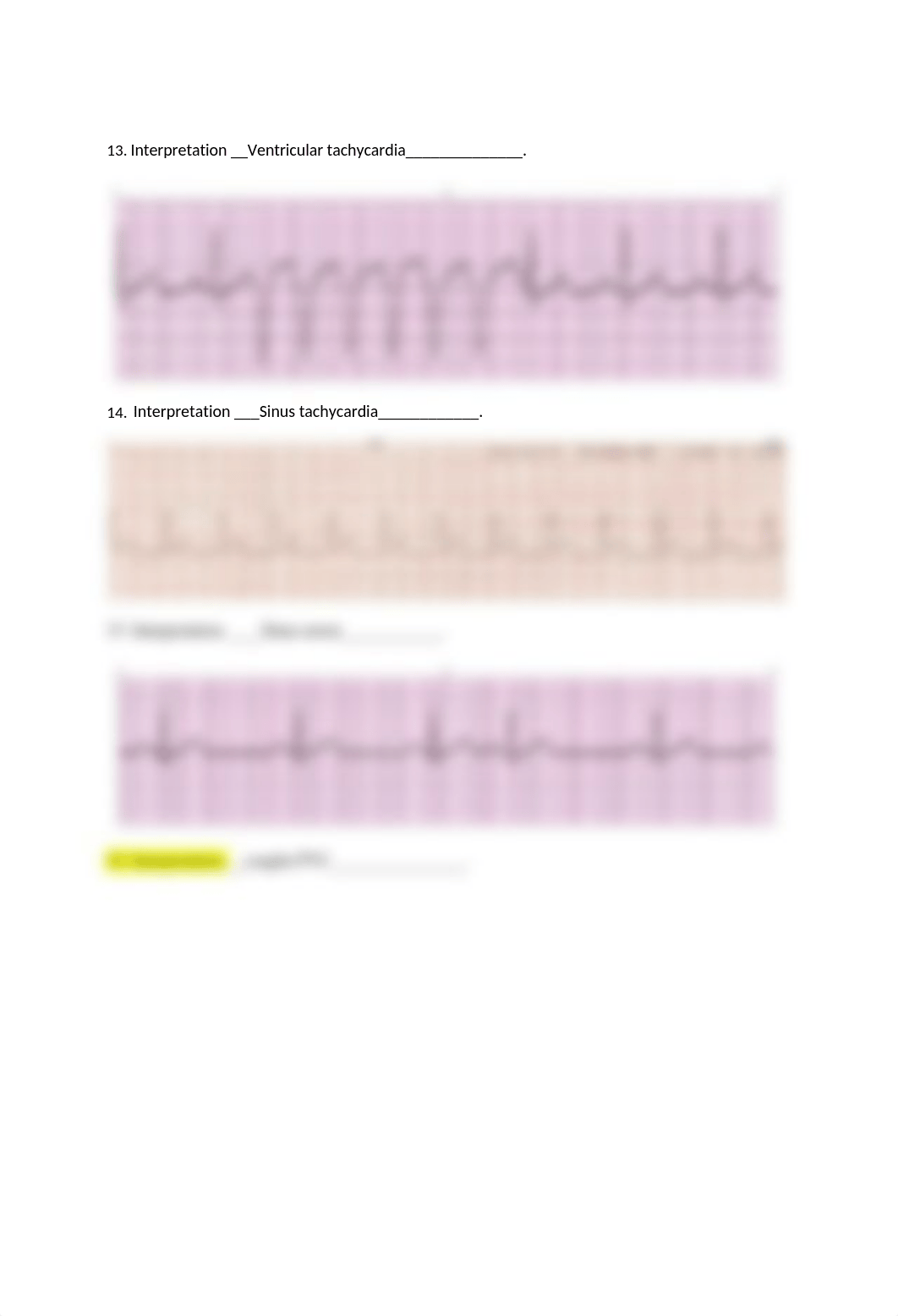 EKG Packet.docx_dsytsec7bdo_page4