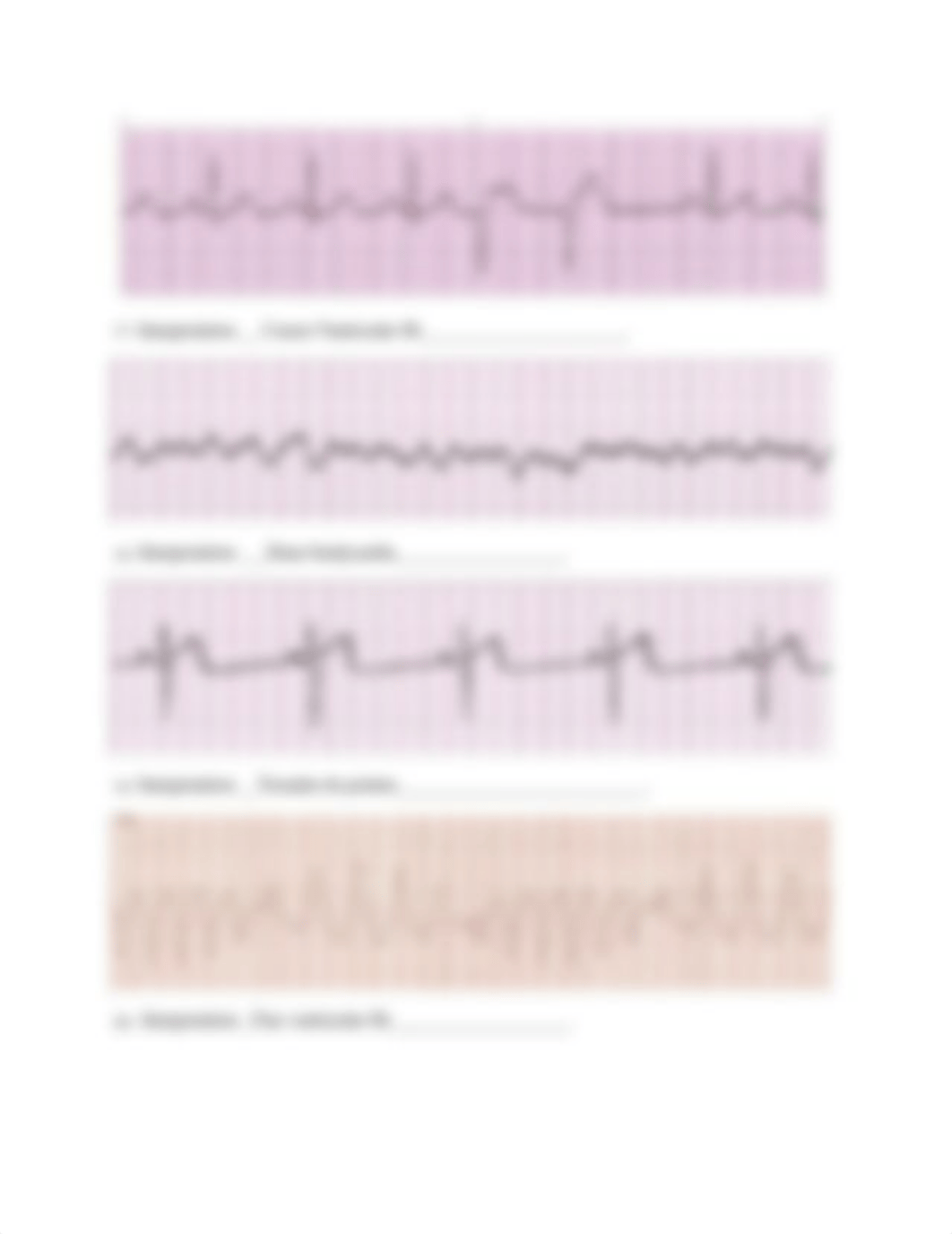 EKG Packet.docx_dsytsec7bdo_page5