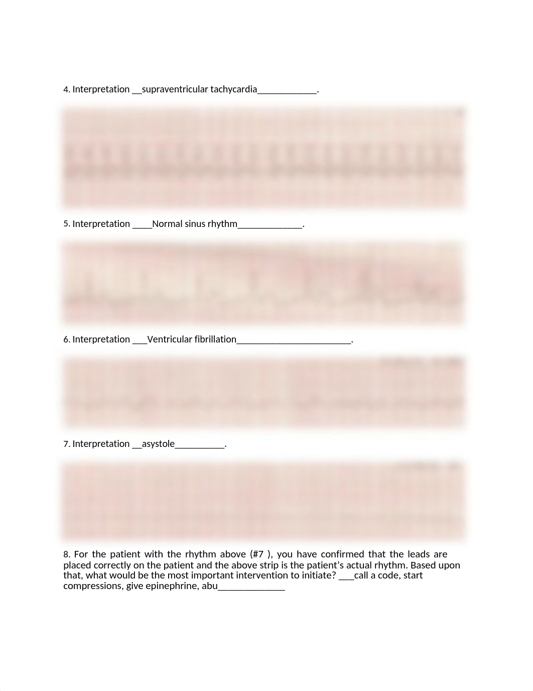 EKG Packet.docx_dsytsec7bdo_page2