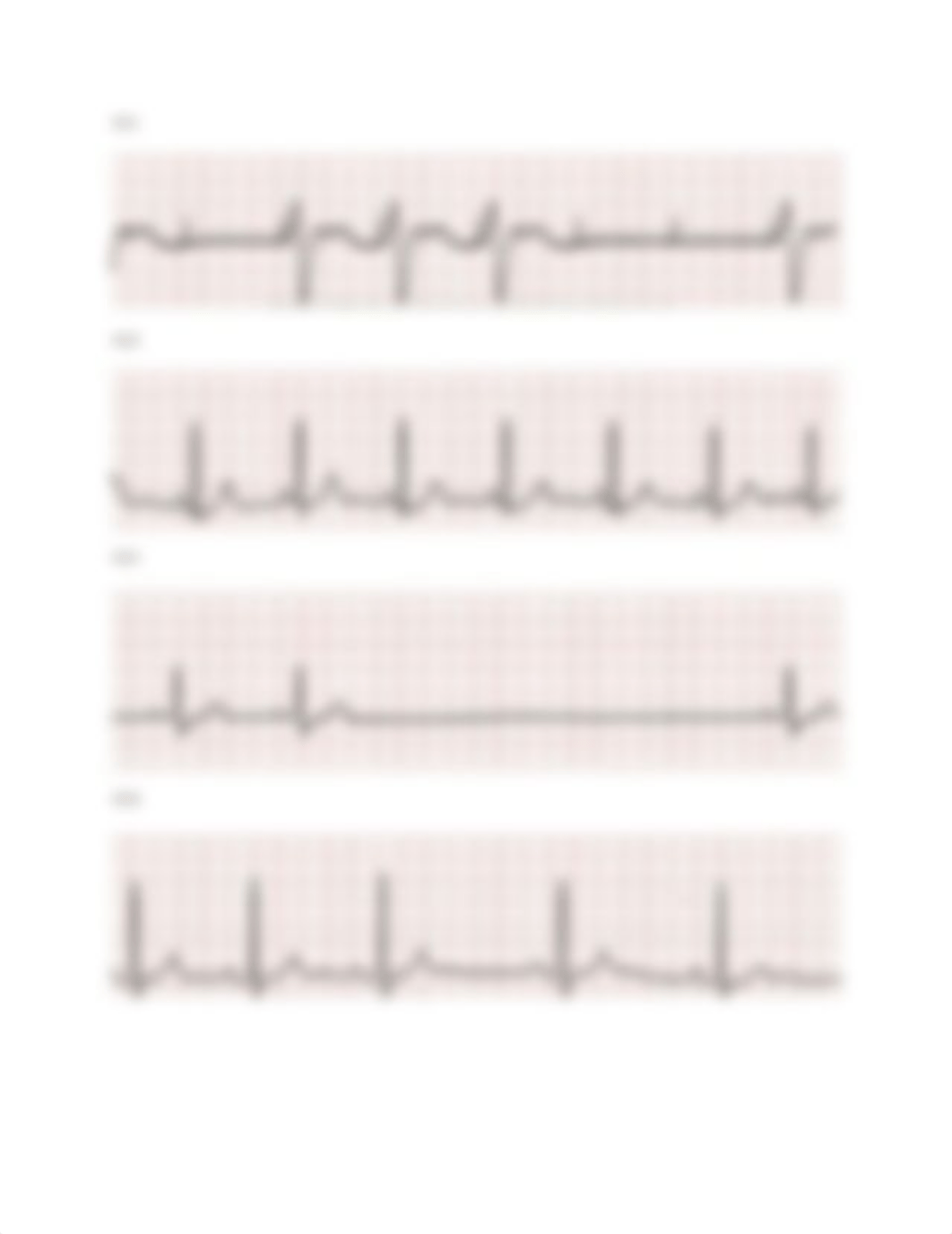 EKG test for healthstream.docx_dt0v5dd6eox_page4