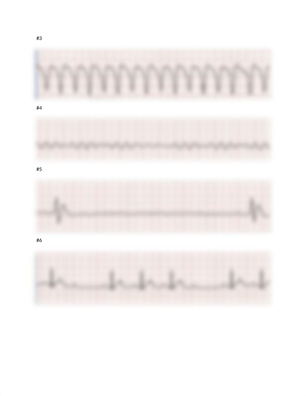 EKG test for healthstream.docx_dt0v5dd6eox_page2