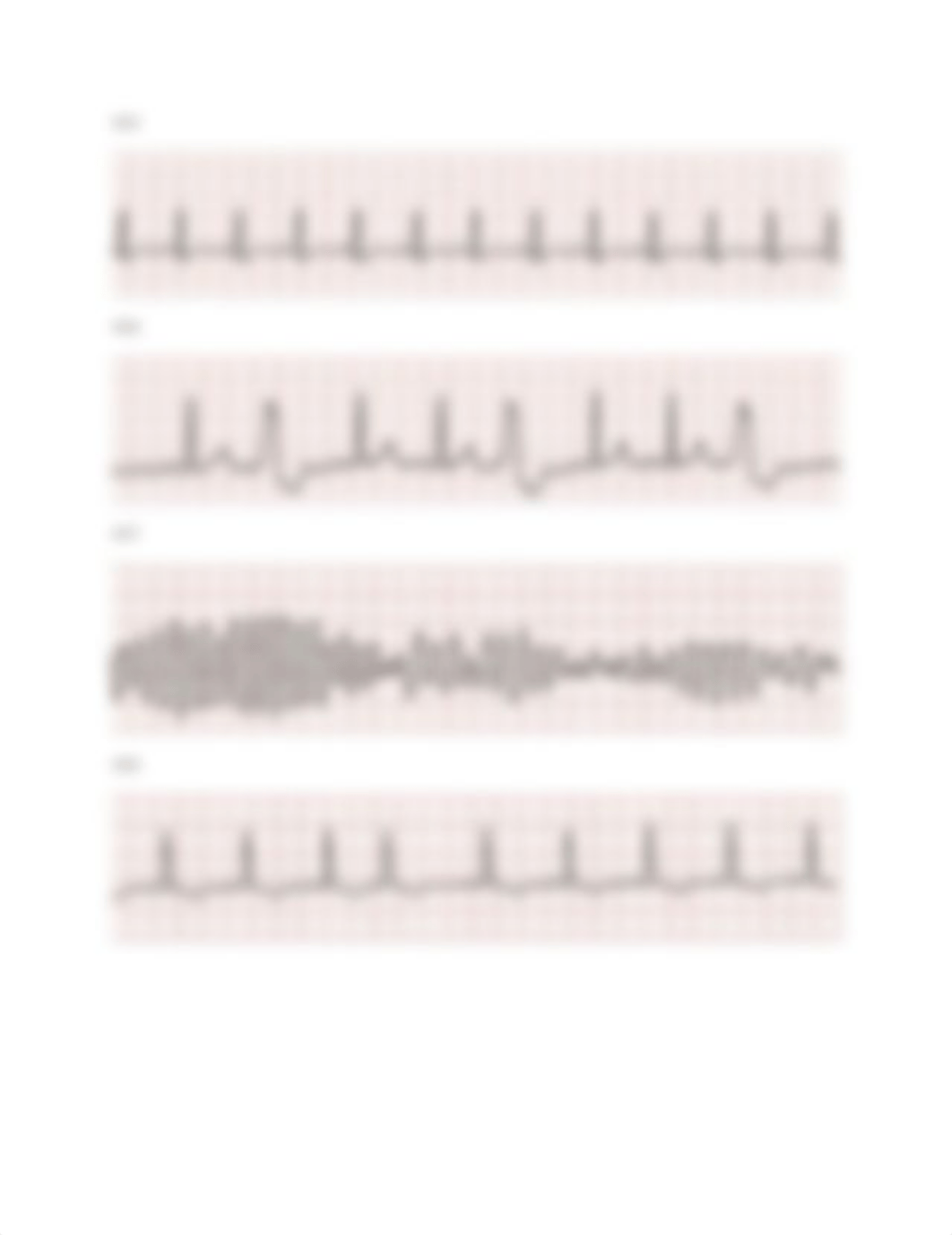 EKG test for healthstream.docx_dt0v5dd6eox_page5