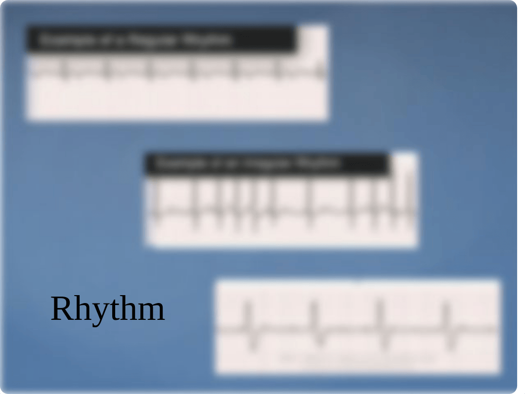 EKG Interpretation.pptx_dt1tzil962c_page5