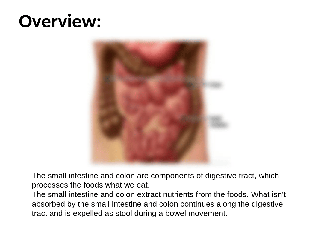 Intestinal Obstruction.ppt_dtfs46sl2wu_page2