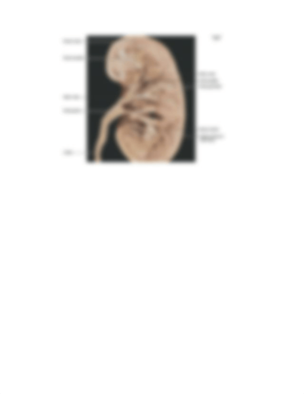 LTemple_KidneyLabReport .pdf_dthd5qr8nqz_page2