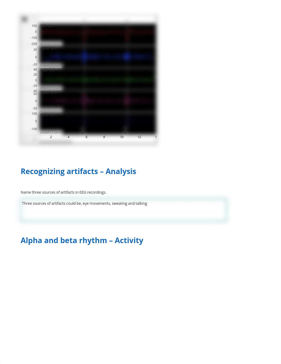 Electroencephalography (EEG) - Lab report.pdf_dtj1lsz0vm7_page2