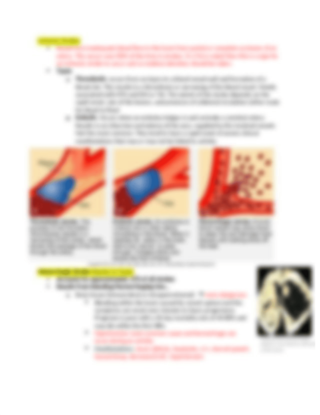 Cerebral Vascular Accident.docx_dtj481e557e_page2