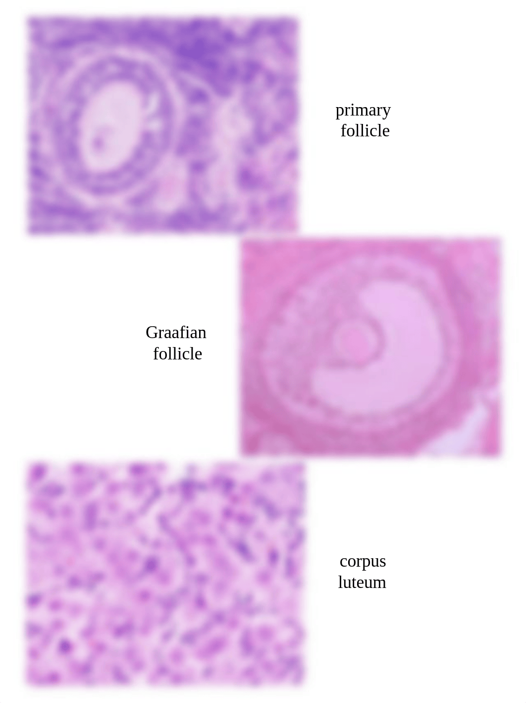 A&P II Lab Section 1 - Microscopic Images of Endocrine Tissue, Blood Cells, and Lymphatic Tissue.pdf_dtlkwr92xj8_page4