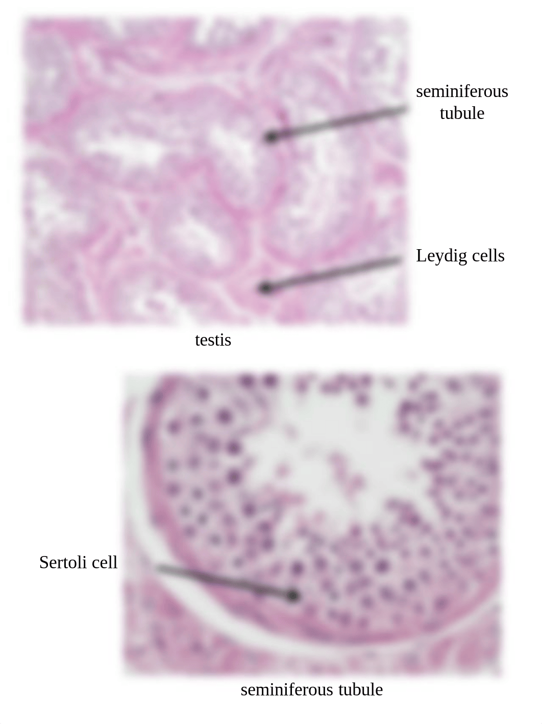 A&P II Lab Section 1 - Microscopic Images of Endocrine Tissue, Blood Cells, and Lymphatic Tissue.pdf_dtlkwr92xj8_page5