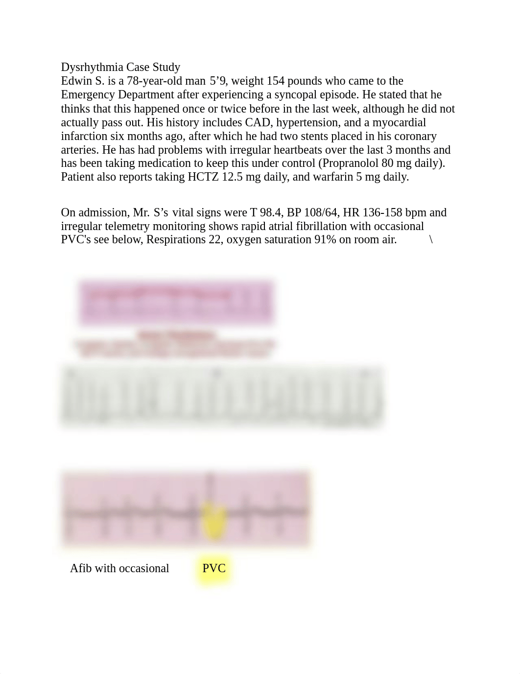 dysrythmias casestudyewv1 (1).pdf_dtosgvxettc_page1