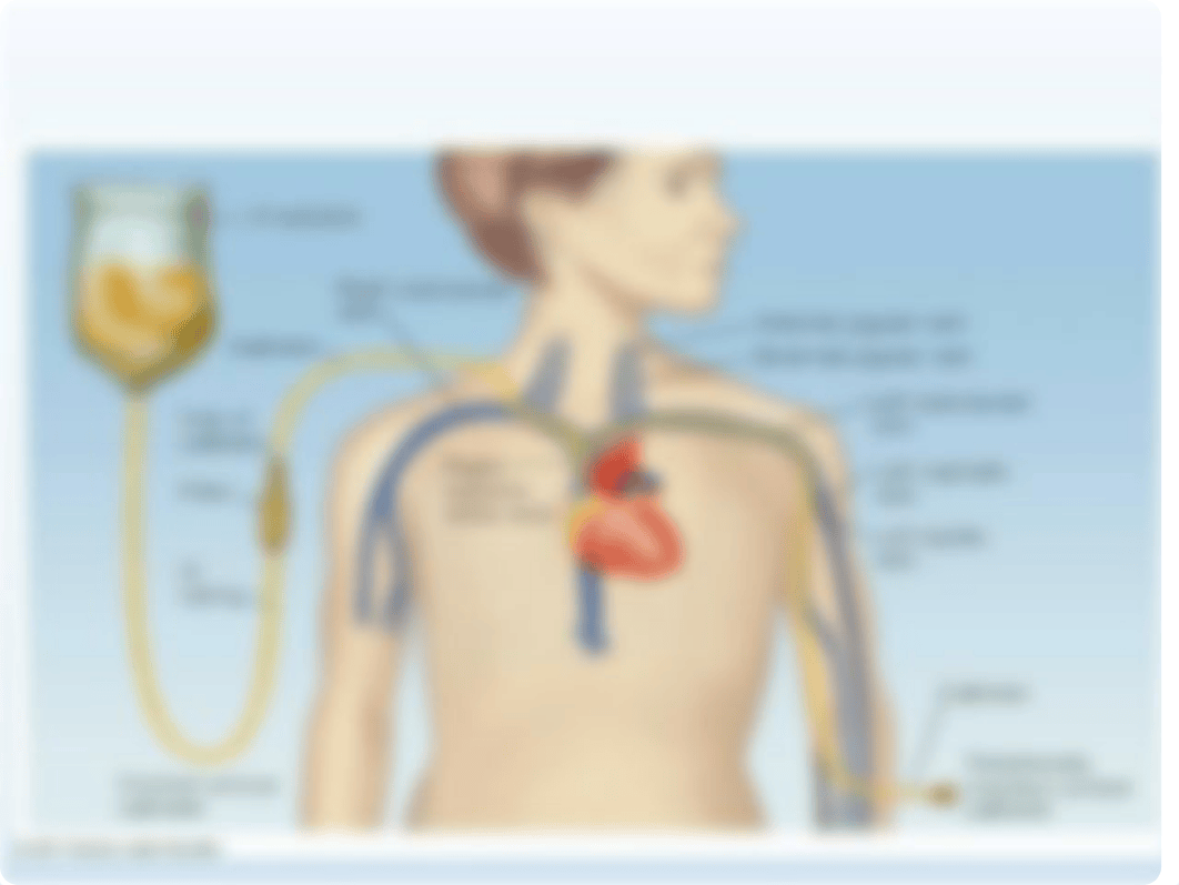 Parenteral Nutrition Part 1.ppt_dtpdgkhu178_page3