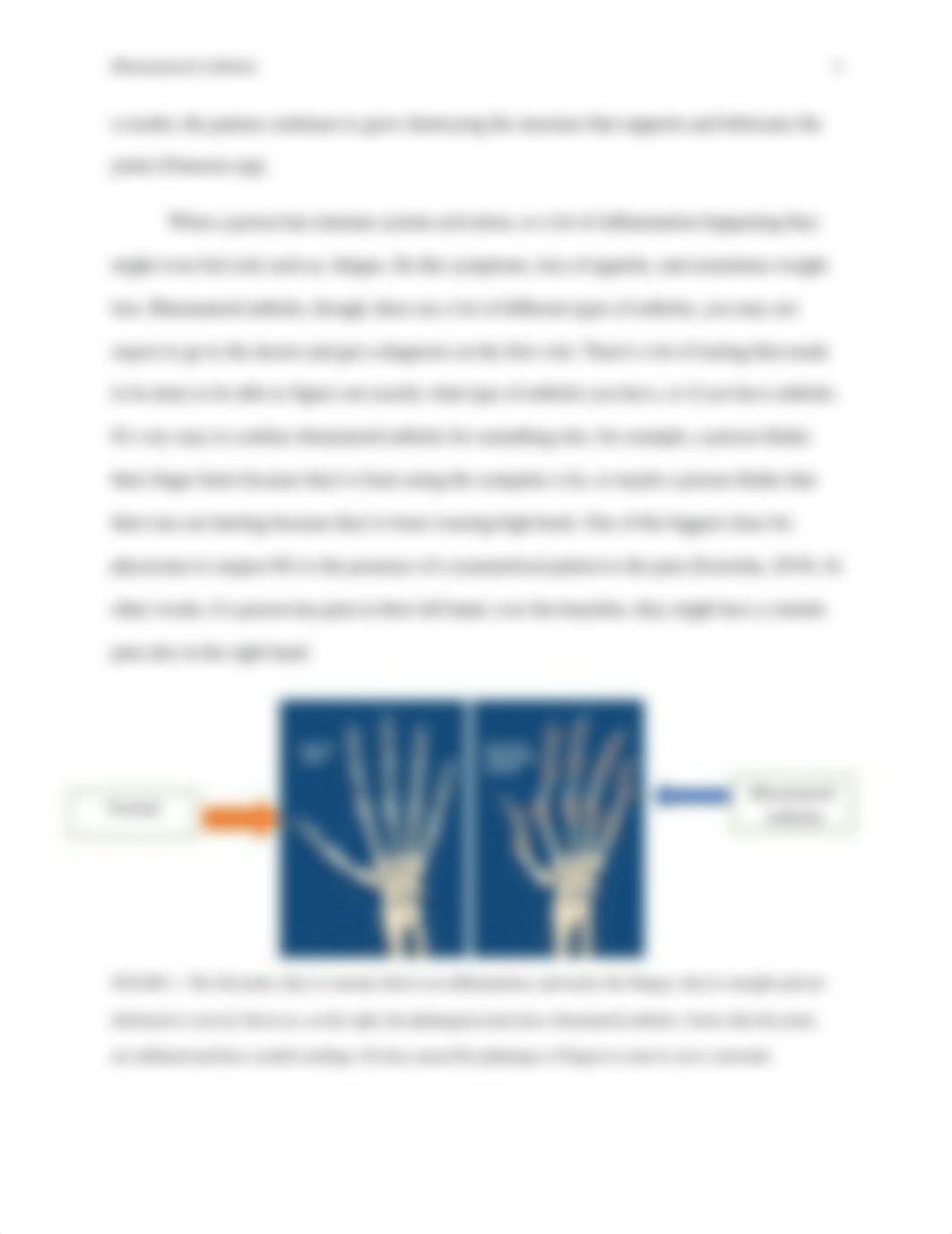 BIO 141- Oquendo. V Rheumatoid Arthritis Paper.pdf_dtpx05wl5df_page3