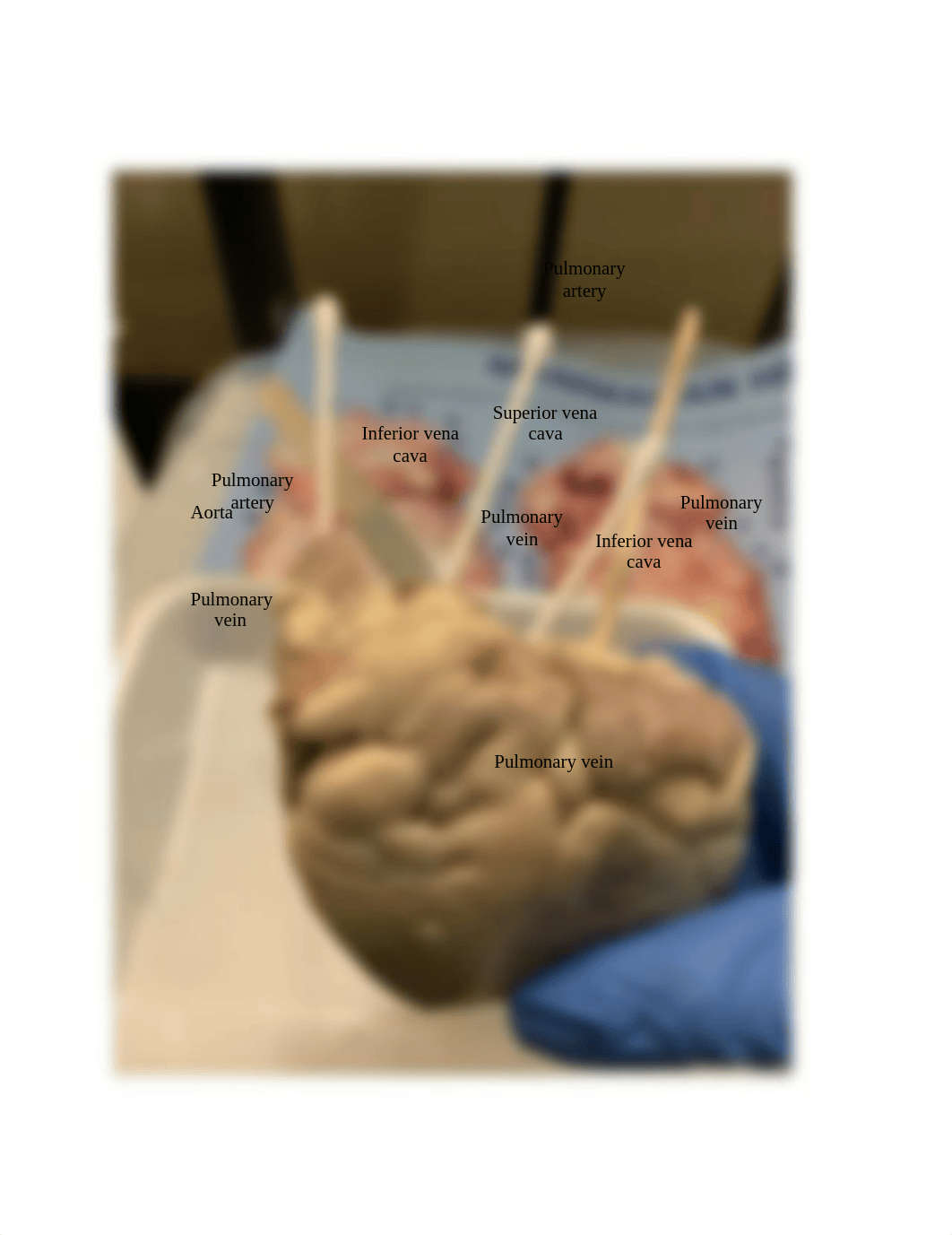 Heart Dissection answer sheet.docx_dtt70vyy65i_page3